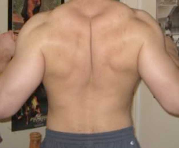 Man is pinching the shoulder blades