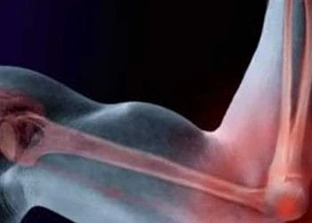 bone tissues