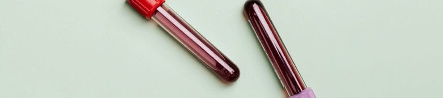 two vials of human blood