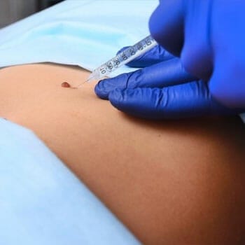 close up image of a person getting injected