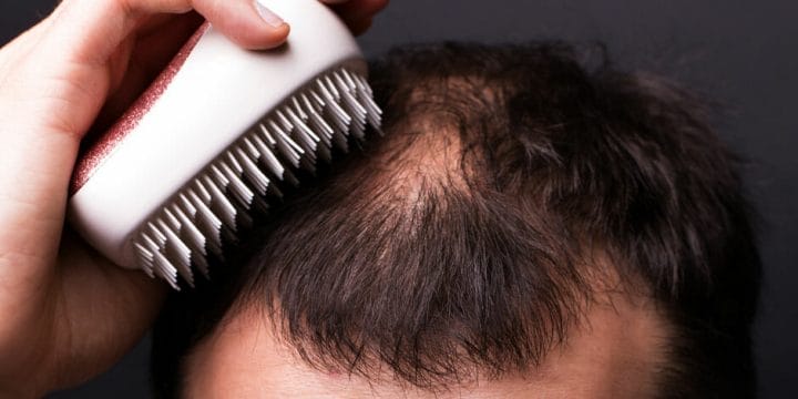 your guide to hair loss and testosterone boosters