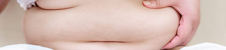 A person holding excess fat