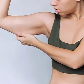female pinching her arm fat