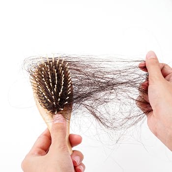 hair brush full of hair loss strands