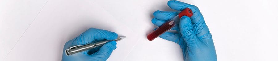 hand view of a person showing a blood sample