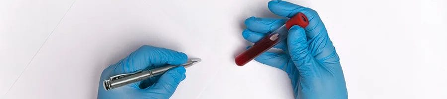 hand view of a person doing blood tests