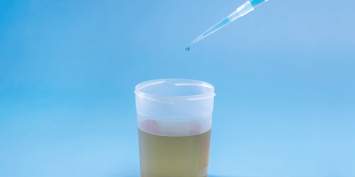 Your guide to protein in urine