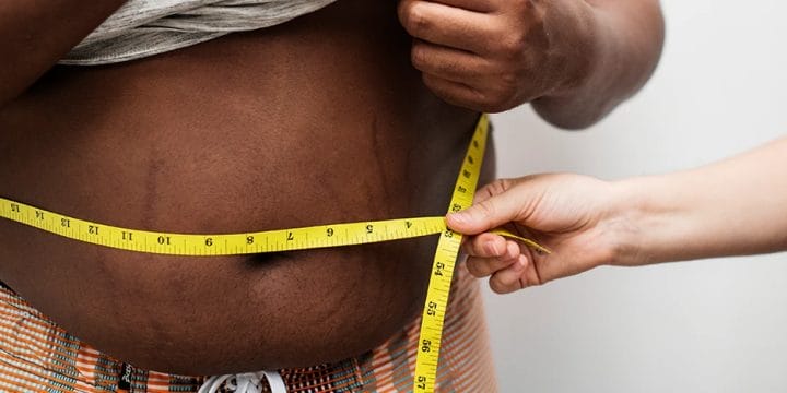 Measuring stomach excess fat