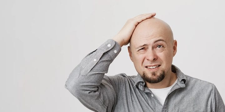 A man holding his bald head