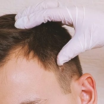 A doctor checking up on a patient with hair loss