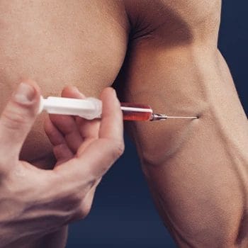 Injecting steroids on biceps