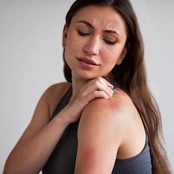 A woman experiencing allergic reactions as a side effect