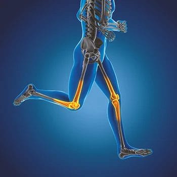 X-ray vision of a runner's leg bones