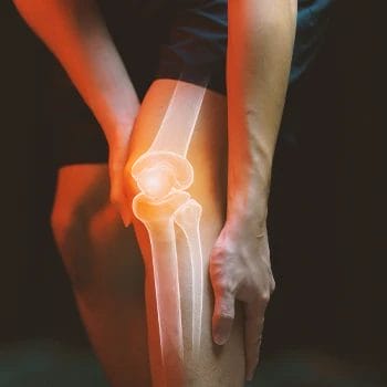 A graphic of knee joints on a person
